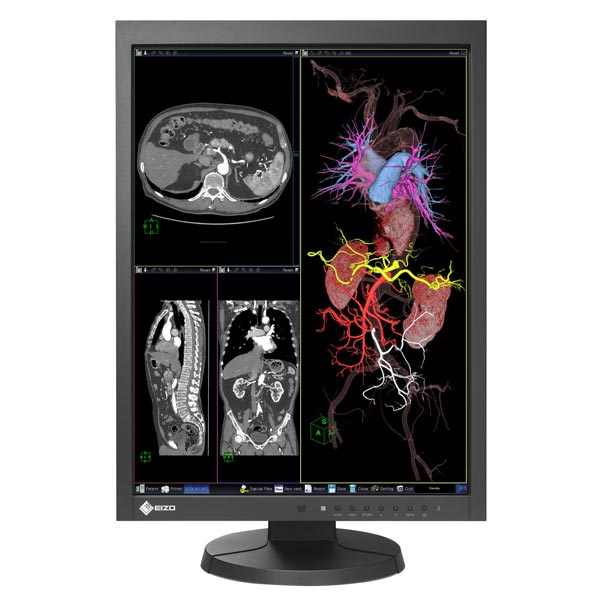 Monitor médico (2MP) Eizo RadiForce MX216-SB